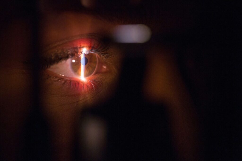 Debunking Common Myths About Laser Eye Surgery and Recovery